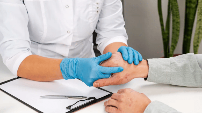 Man Left With Burns After Dermatology Clinic Gives Wrong Treatment