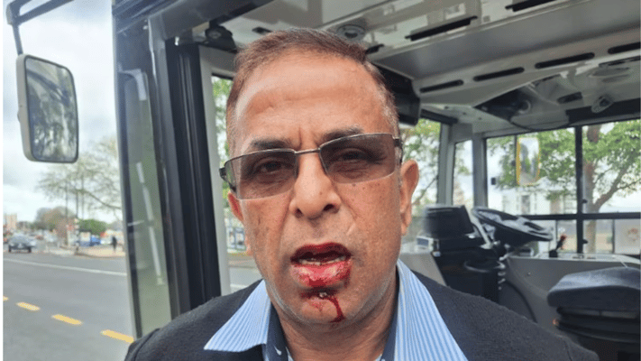 Auckland bus driver Rajnish Trehan was assaulted on Saturday morning by an unruly passenger who refused to pay his fare and shouted racial abuse, leaving Trehan requiring hospital treatment.