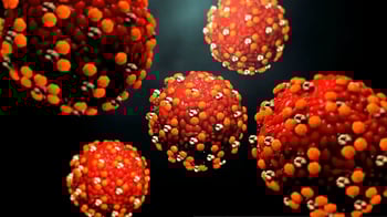 Measles Exposure Reported On Cook Strait Ferry