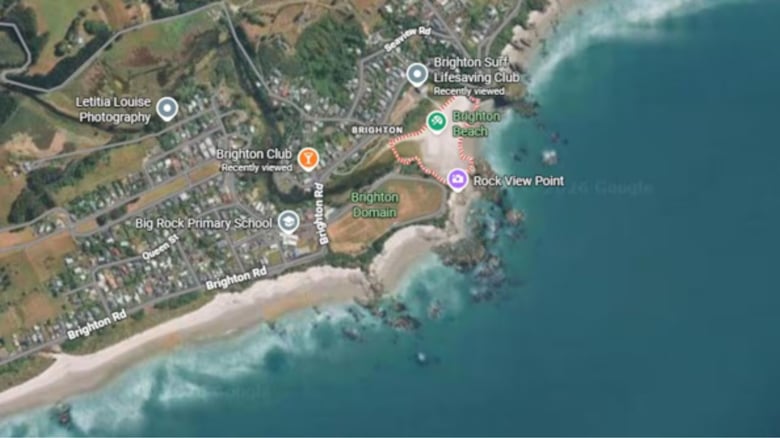 Marine mammal bite at&nbsp;Dunedin beach&nbsp;sends person to hospital