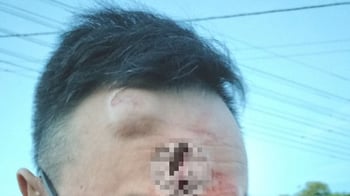 West Auckland dad assaulted confronting car thieves as police close Case