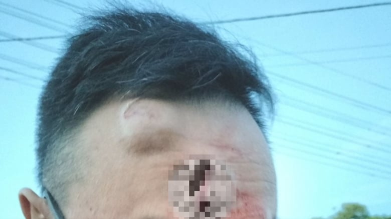 West Auckland dad assaulted confronting car thieves as police close Case