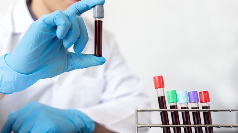 Unexpected Lab Findings Prompt Patients To Undergo Retests