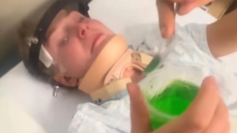 Young rugby player breaks neck in head-high tackle