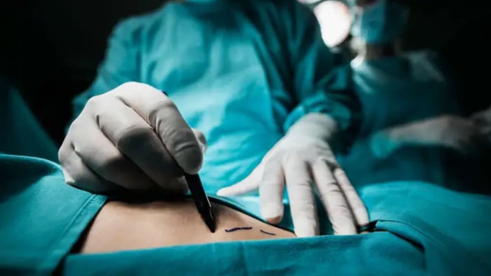 Woman Dies After Weight-Loss Surgery at Private Hospital: Coroner Finds Delayed Transfer and Record Errors