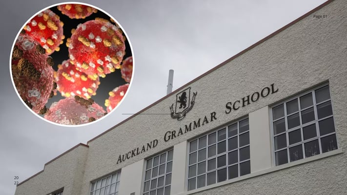 Health NZ confirms measles case at Auckland Grammar School, contact tracing under way