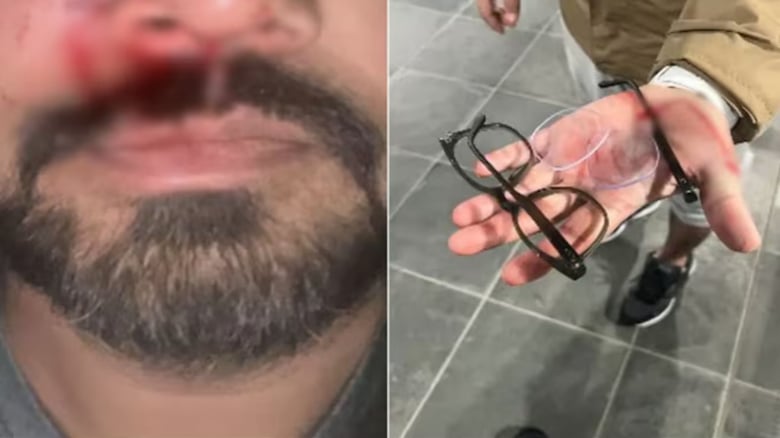 Indian-Origin Man Assaulted In Dublin In Alleged Racist Attack