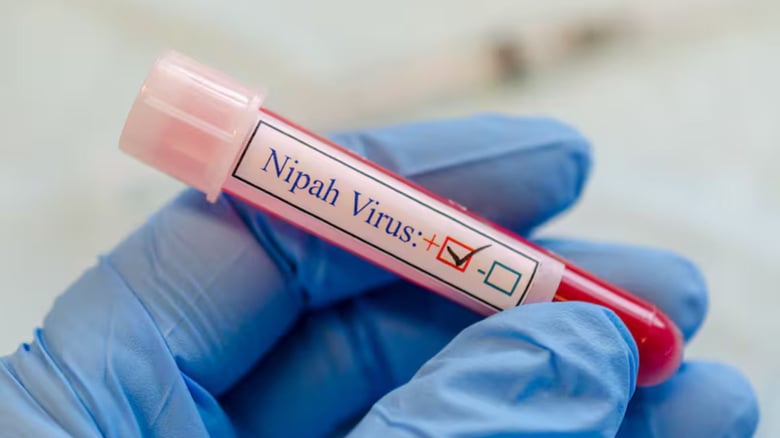 Nipah Virus: What Travellers Should Know About The Deadly Infection