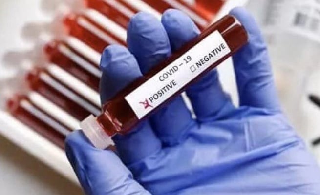 With 3,604 new cases, India's Covid tally surges past 70K