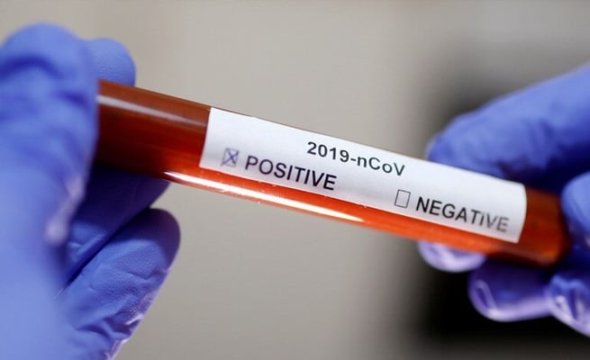 Fiji : Over 2,400 Fijians screened for COVID-19, 18 fresh cases