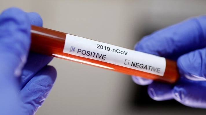 Covid patients dying of unique fungus, researchers begin probe