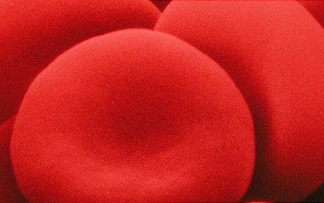 Iron-deficiency anaemia in Indian women and children