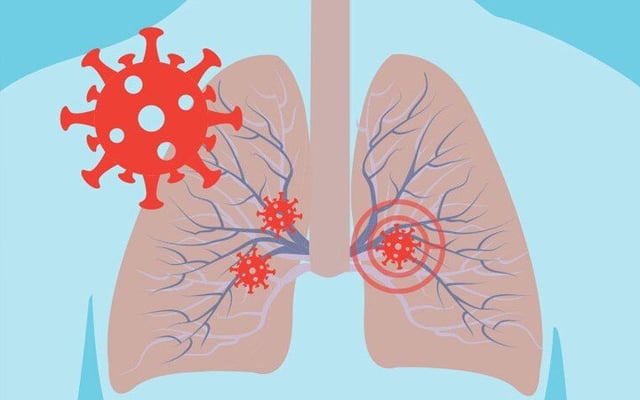 Most lungs recover well in 3 months after Covid: Study