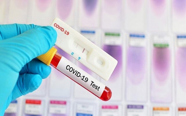 New COVID-19 rapid test kit receives scientific seal of approval