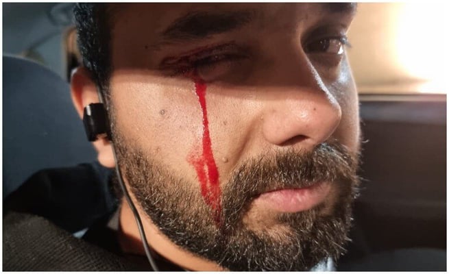 Road-rage turns into alleged racial abuse: Kiwi-Indian taxi  driver assaulted.