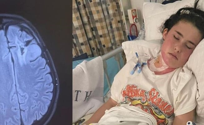 Kiwi teen to be awake through brain tumour surgery