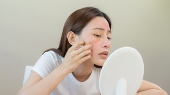 Foods that may be causing your acne: What to cut for clearer skin