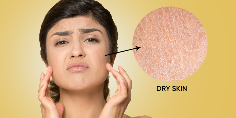 Winter Survival Tips: Beat Dry Skin & Cold Weather